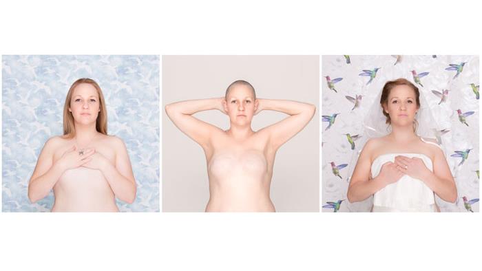 Three images of a woman with breast cancer