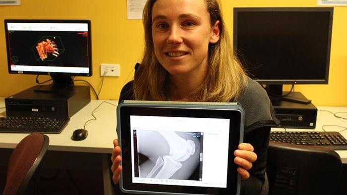 A photograph of a lady holding a tablet featuring an x-ray 